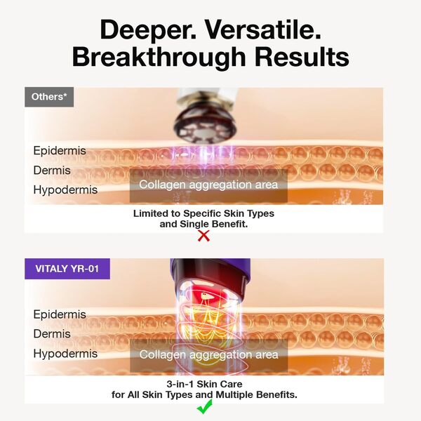 Machine de raffermissement de la peau, masseur facial luminothérapie pour le visage, appareil facial à micro-courant 3 en 1, appareil anti-âge à usage domestique, 5 niveaux pour raffermir le visage