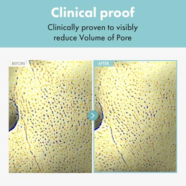  Découvrez notre analyse sur la crème Pore Refiner de Tosowoong : efficacité, texture et résultats pour un teint sans imperfections.